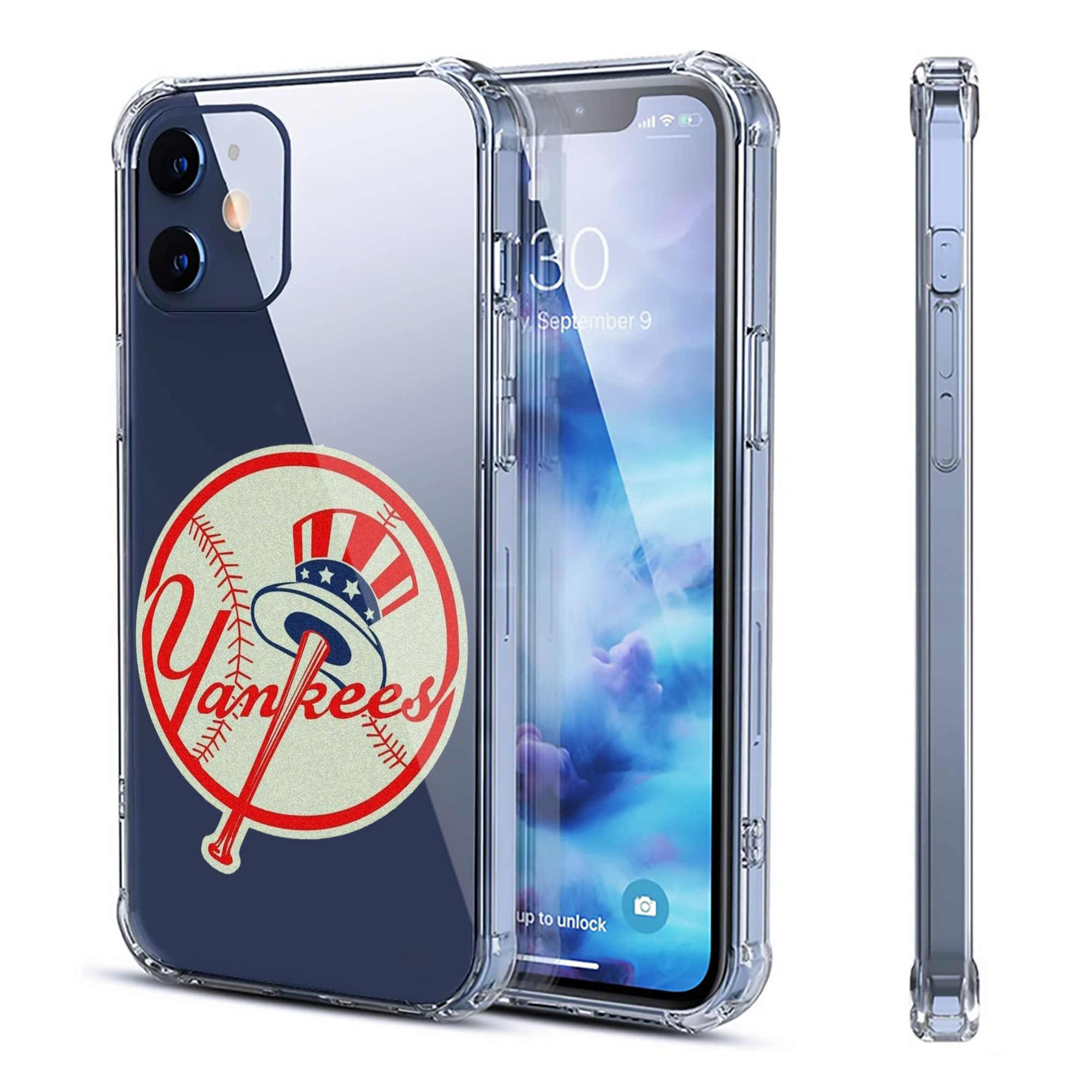 New York Yankees Logo Clear IPhone 12 Case – Soft TPU With UV Print – Enhanced Drop Protection, Precise Fit, Anti-Fingerprint, Customizable Design, Scratch-Resistant, Yellow-Resistant